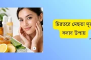চিরতরে মেছতা দূর করার উপায়: ঘরোয়া ও চিকিৎসা পদ্ধতির সম্পূর্ণ গাইড