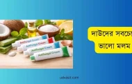 দাউদের সবচেয়ে ভালো মলম এর নাম জেনে নিন